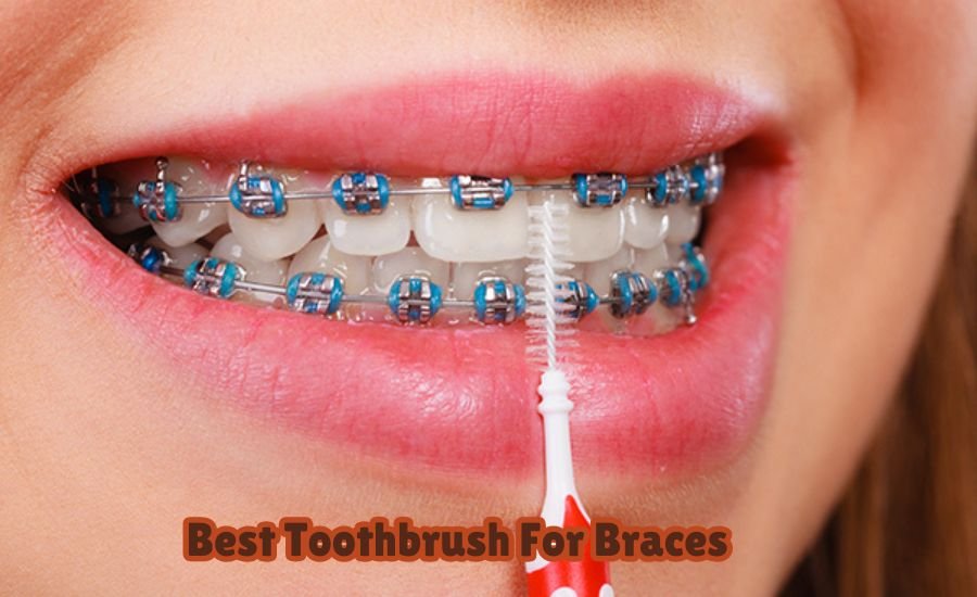 best toothbrush for braces